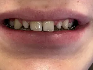 Done  by  Dr.  Jill