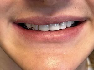 Done  by  Dr.  Jill